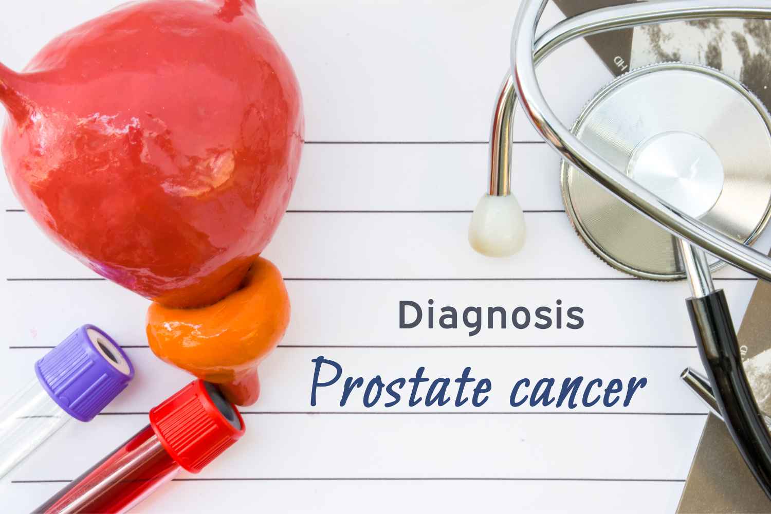 Prostate Cancer In Younger Men: Recognising Symptoms And Risks - Assure 